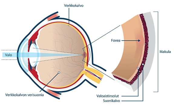 Makulaturvotuksen vaikutus näköön